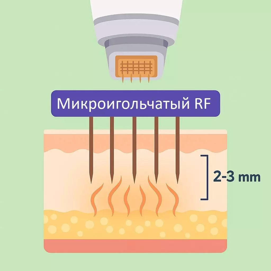 микроиглы.jpg